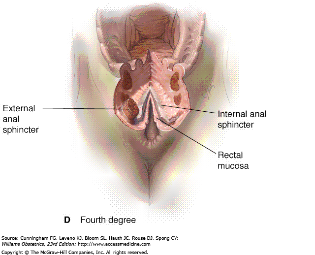 perineal wound4.GIF